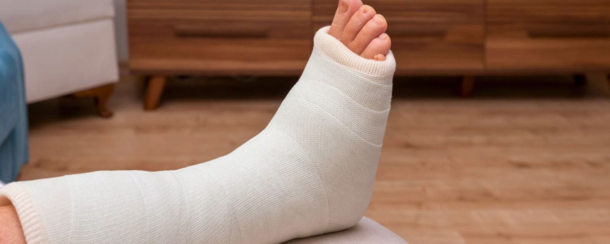 ankle-joint-replacement-recovery