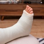 ankle-joint-replacement-recovery